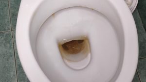 chym-vidmyty-nalit-v-unitazi